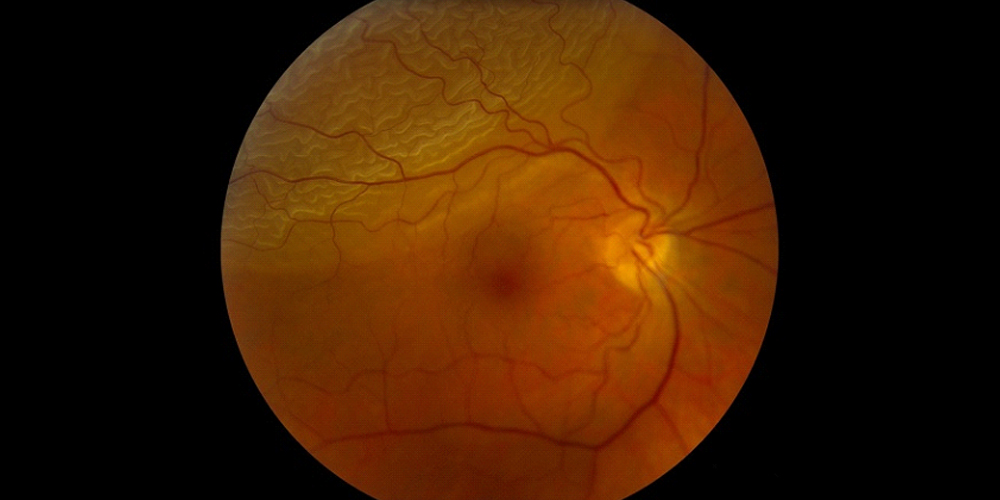 Ophthalmic Emergency